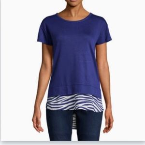 Blue Zebra Print Shirt 💙🦓